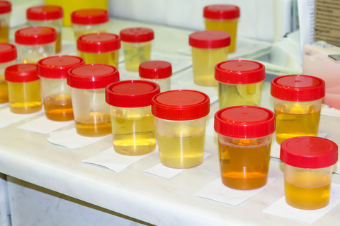 Penis Pee colors